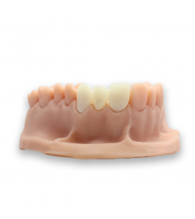Alias Dental Temp C&B